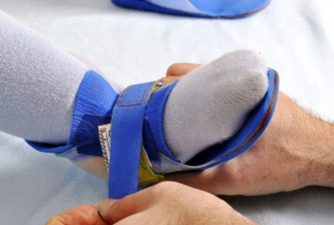 Pediatric Prosthetics and Orthotics