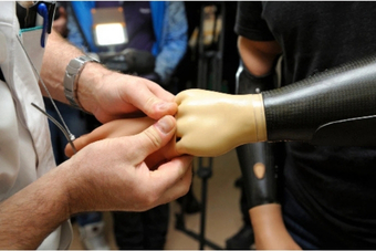Prosthetics at Opc Care